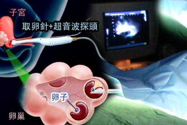 最好的武汉代生医院 武汉大学人民医院试管婴儿技术怎么样? ‘中期唐筛看男女