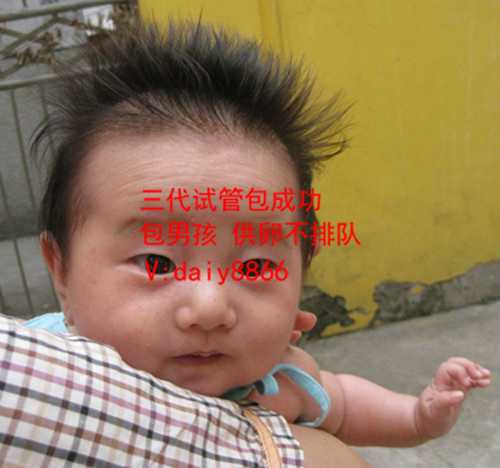 上海代生市场价_试管婴儿胚胎移植后注意事项